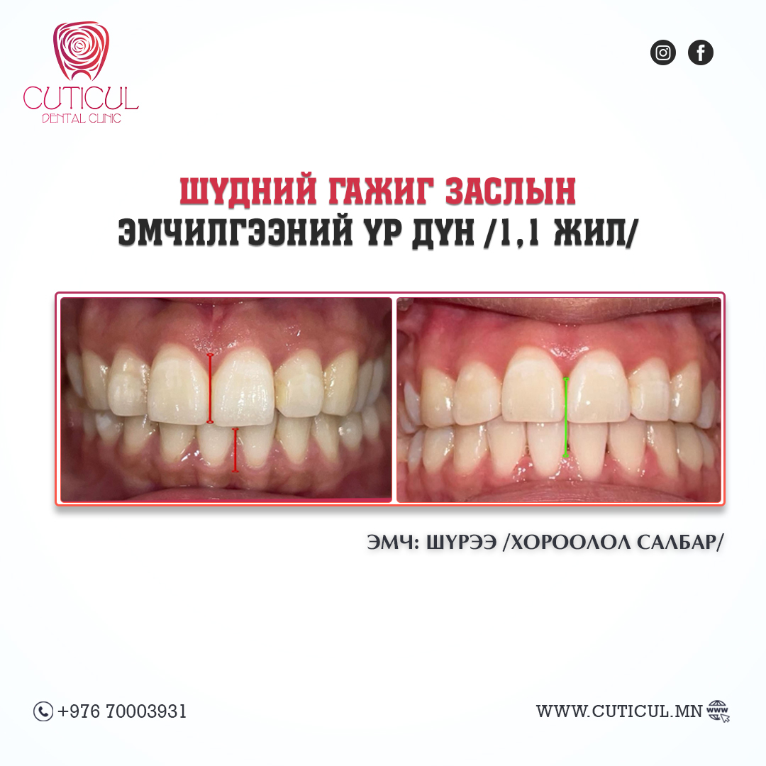 Result Image 1